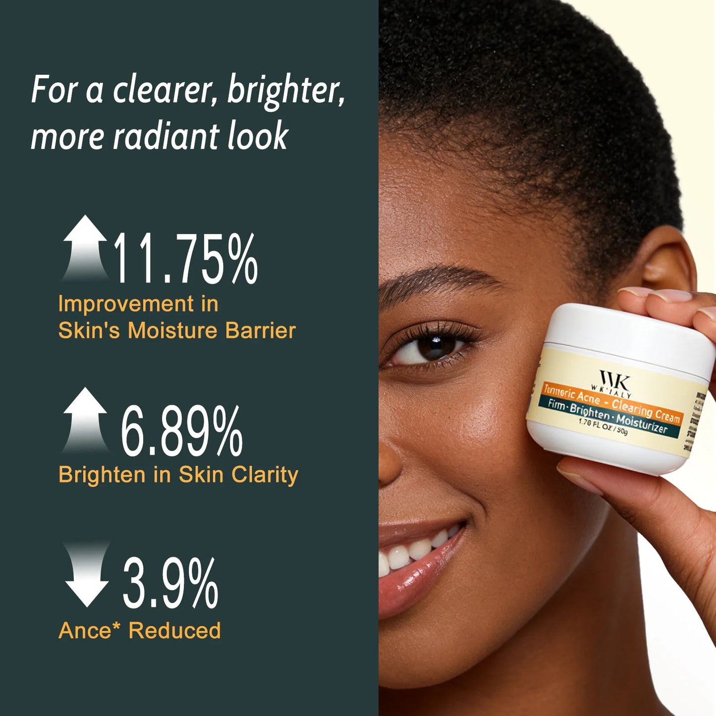 Kyliefit Turmeric Acne Cream For Brightening And Moisturizing Skincare