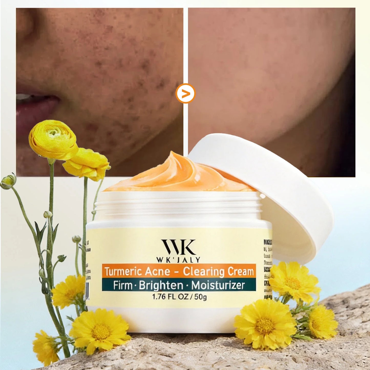 Kyliefit Turmeric Acne Cream For Brightening And Moisturizing Skincare