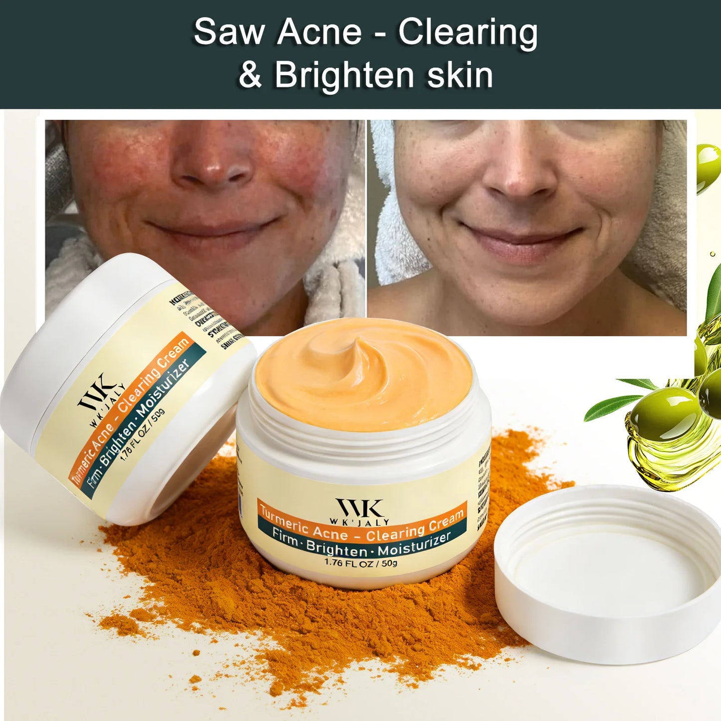Kyliefit Turmeric Acne Cream For Brightening And Moisturizing Skincare